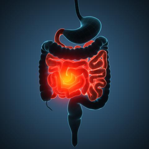 Illustration of intestinal disease.