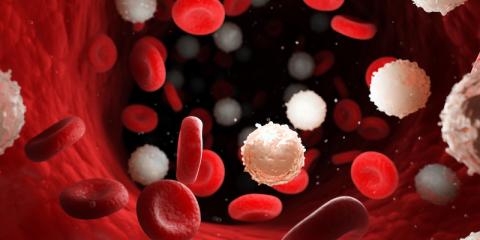 3D image of too many white blood cells due to blood cancer
