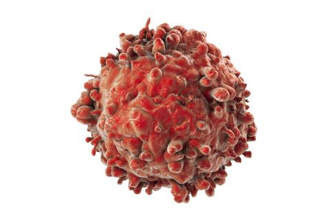 Image of Leukaemia white blood cell
